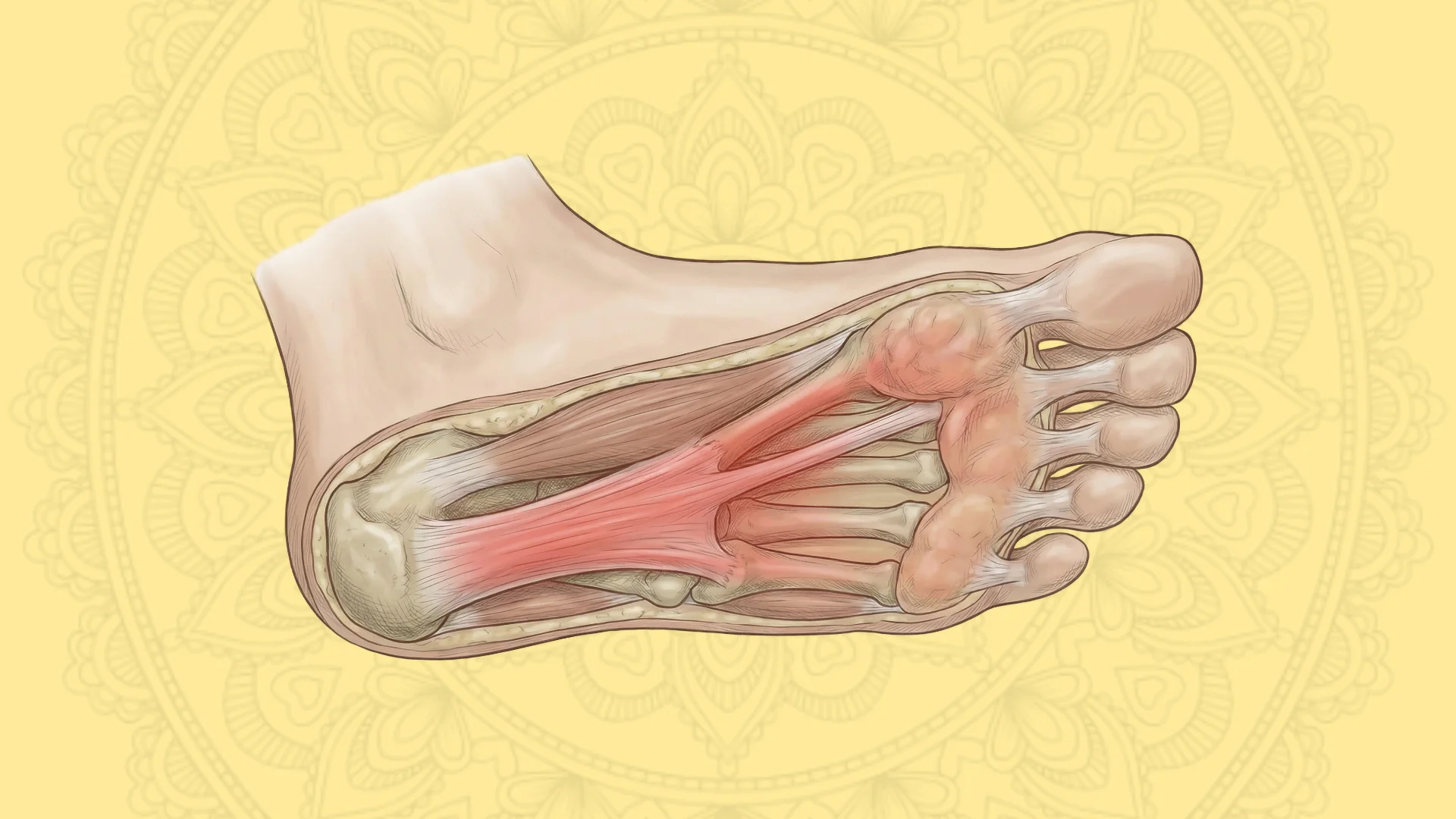 Plantar Fasciitis Support